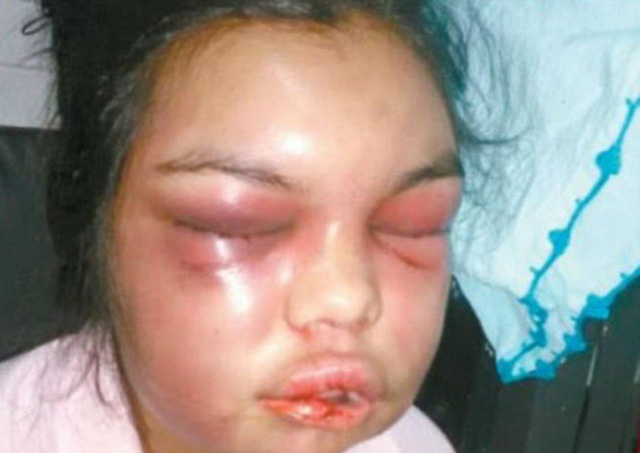 Mỗi lần được like trên facebook lại bị chồng cho ăn đấm