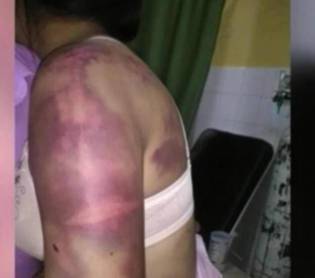 Mỗi lần được like trên facebook lại bị chồng cho ăn đấm