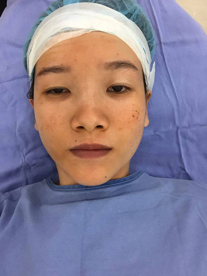 Màn lột xác bất ngờ của nữ sinh ĐH Y khoa Vinh từng bị nhà người yêu từ chối vì có đôi mắt lươn