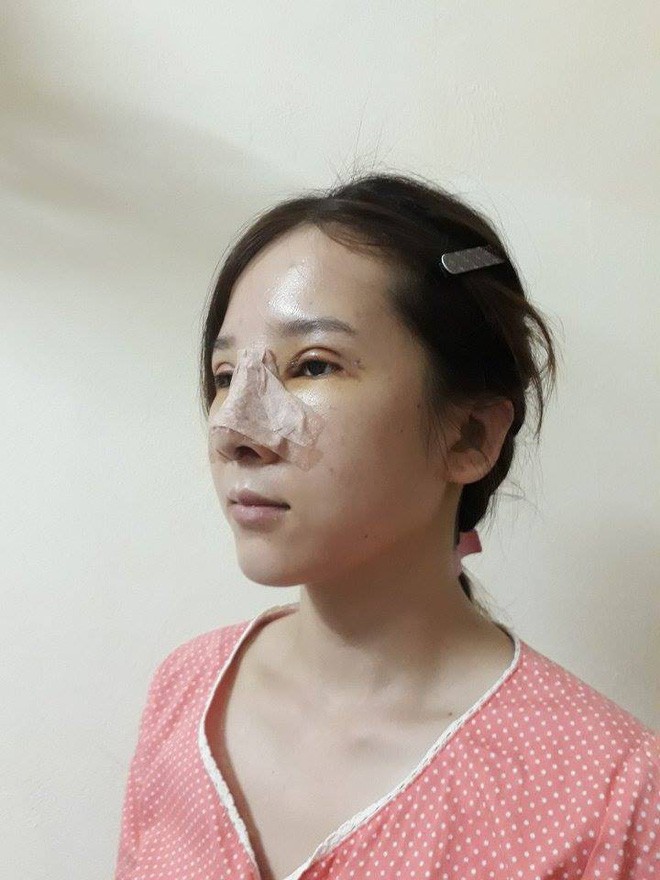 Màn lột xác bất ngờ của nữ sinh ĐH Y khoa Vinh từng bị nhà người yêu từ chối vì có đôi mắt lươn Màn lột xác bất ngờ của nữ sinh ĐH Y khoa Vinh từng bị nhà người yêu từ chối vì có đôi mắt lươn