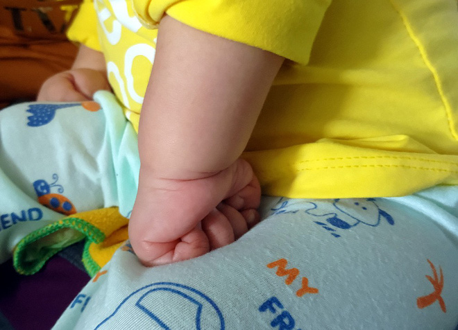 Xót thương bé gái hơn 1 tuổi bị côn trùng đốt khiến tay chân co quắp, teo não không thể nhận thức