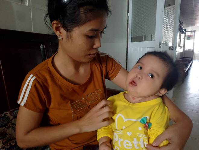 Xót thương bé gái hơn 1 tuổi bị côn trùng đốt khiến tay chân co quắp, teo não không thể nhận thức