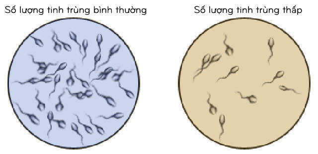 Tinh binh ít có phải do vợ chồng tôi yêu quá nhiều? Tinh binh ít có phải do vợ chồng tôi yêu quá nhiều?