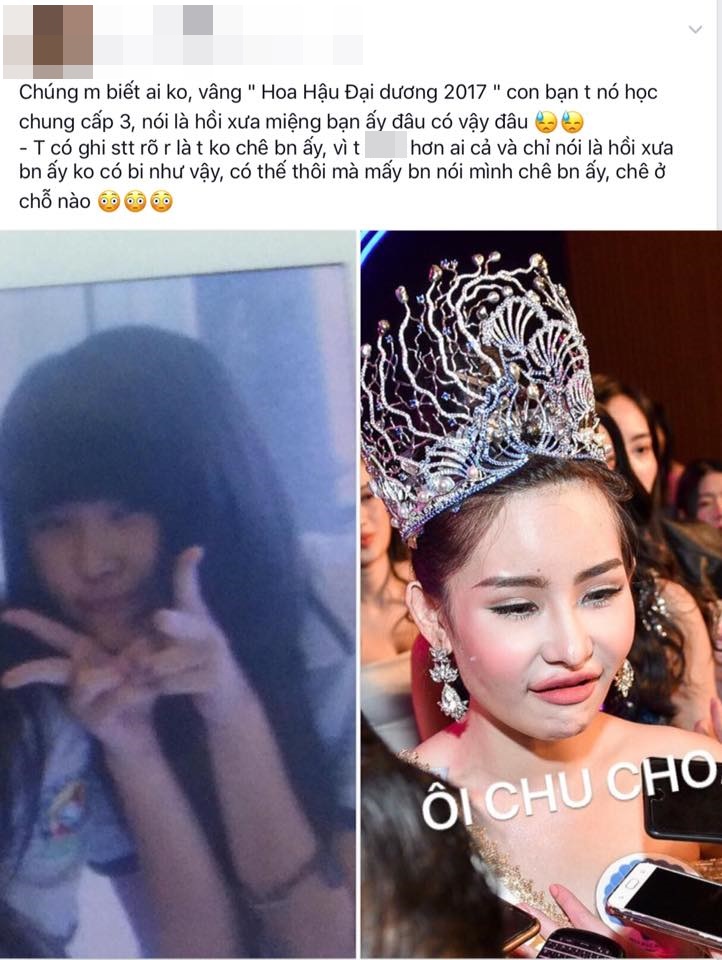 Choáng vì gương mặt tròn lạ, mũi tẹt của Hoa hậu Đại dương 2017