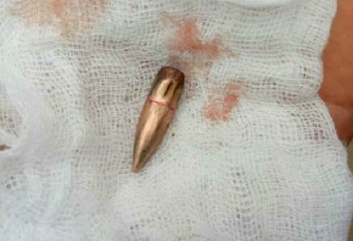 Phó thủ tướng yêu cầu làm rõ việc đạn lạc găm trúng người dân