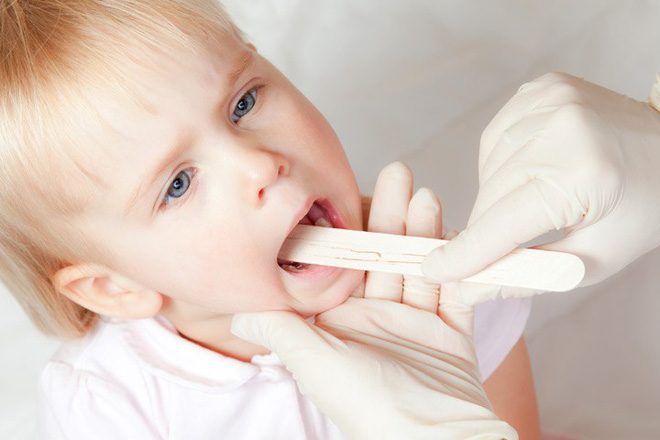 Những dấu hiệu này sẽ giúp bạn nhận biết đó là cơn ho thông thường hay là dấu hiệu của bệnh cực nguy hiểm