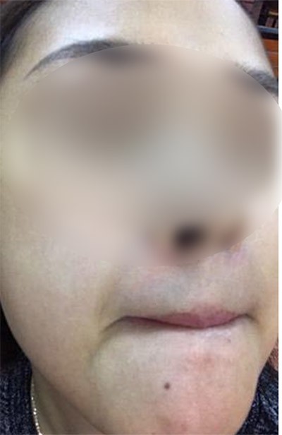 Khách hàng từng là đại lý của TS Group tố bị mẩn ngứa khi dùng sản phẩm: Bây giờ liên hệ với họ như đi mò kim đáy bể