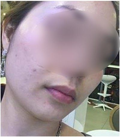 Khách hàng từng là đại lý của TS Group tố bị mẩn ngứa khi dùng sản phẩm: Bây giờ liên hệ với họ như đi mò kim đáy bể