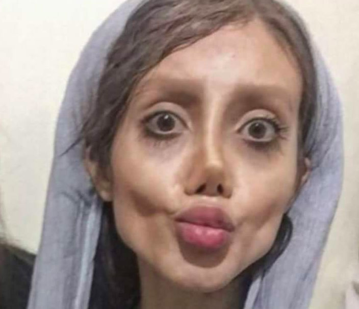 Bị dân tình ném đá dữ dội, cô gái phẫu thuật giống Angelina Jolie chính thức lên tiếng phản pháo Bị dân tình ném đá dữ dội, cô gái phẫu thuật giống Angelina Jolie chính thức lên tiếng phản pháo