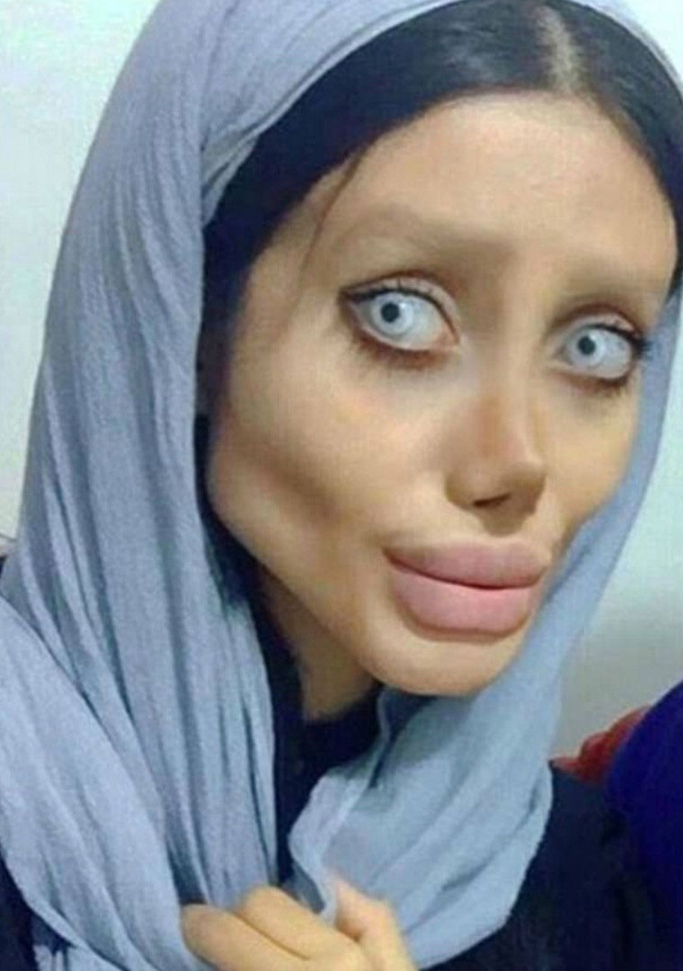 Bị dân tình ném đá dữ dội, cô gái phẫu thuật giống Angelina Jolie chính thức lên tiếng phản pháo Bị dân tình ném đá dữ dội, cô gái phẫu thuật giống Angelina Jolie chính thức lên tiếng phản pháo