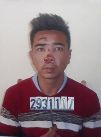 Thanh Hóa: Ghen tuông, đâm trọng thương người tình bằng dao