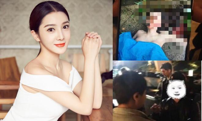 Xác nhận thông tin tiểu Angelababy ở trong khách sạn với người tình trong đêm trượt chân ngã