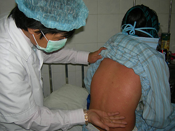 6 bệnh dễ bùng phát trong mùa đông - xuân