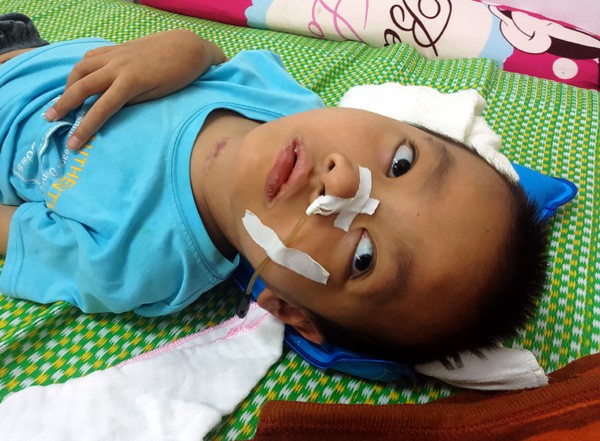 Sau trận sốt cao, bé trai khỏe mạnh thành người tàn phế, bố mẹ khốn khó vì gia cảnh ngặt nghèo