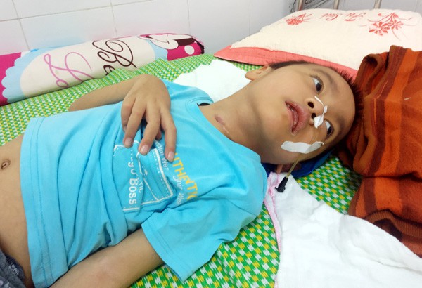 Sau trận sốt cao, bé trai khỏe mạnh thành người tàn phế, bố mẹ khốn khó vì gia cảnh ngặt nghèo