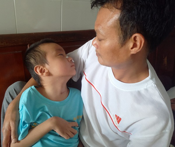 Sau trận sốt cao, bé trai khỏe mạnh thành người tàn phế, bố mẹ khốn khó vì gia cảnh ngặt nghèo