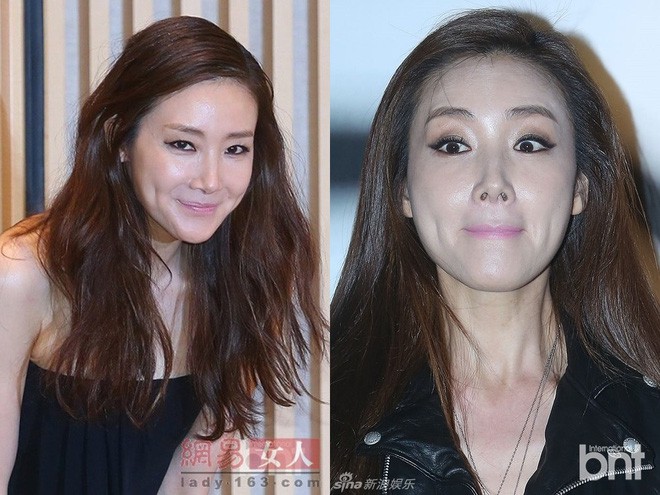 Choi Ji Woo: Ánh hào quang chẳng còn ý nghĩa khi đường về chỉ đơn độc lẻ bóng tuổi xế chiều