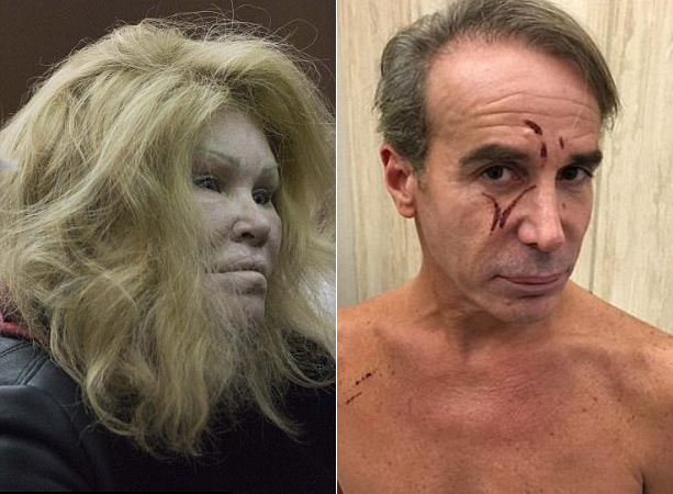 Thảm họa dao kéo Mỹ và bồ trẻ đánh nhau vì chuyện bếp núc