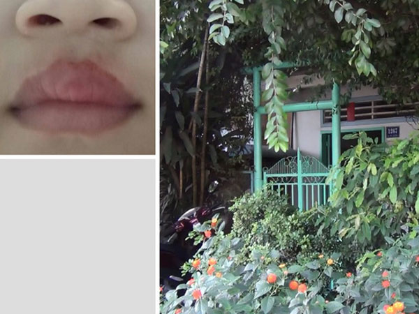 Đình chỉ nhà trẻ tư thục nơi bảo mẫu bạo hành trẻ bằng ớt