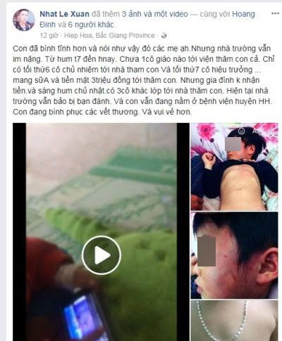 Bắc Giang: Gia đình tố cô giáo đánh con bầm tím toàn thân khi đi học ở trường