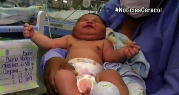 Mẹ sốc khi sinh ra con trai nặng 6,4 kg