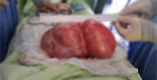 Thực hư chuyện tế bào ung thư gặp vàng thì sán lại, gặp tỏi thì chạy xa đang được người dùng mạng Việt Nam chia sẻ