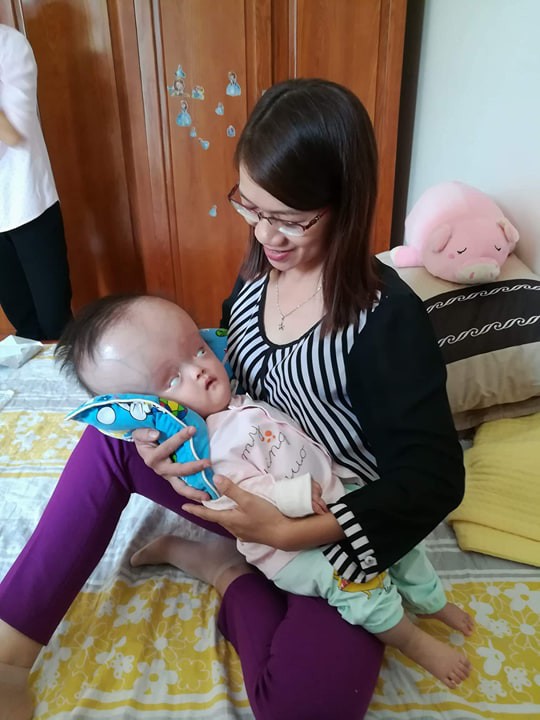 Đã quyên góp được gần 500 triệu đồng chuẩn bị cho ngày mai đưa bé gái đầu to đi Singapore chữa bệnh