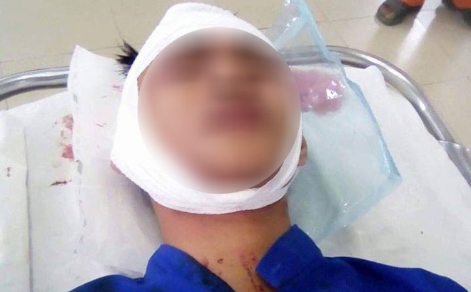 Nhóm thanh niên thấy người là chém khiến người dân Đồng Nai hoang mang