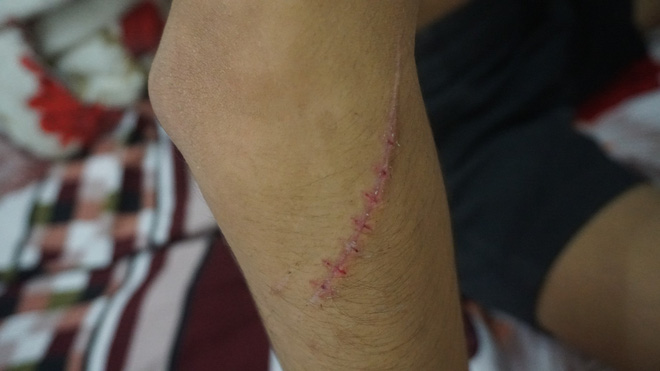 Nhóm thanh niên thấy người là chém khiến người dân Đồng Nai hoang mang