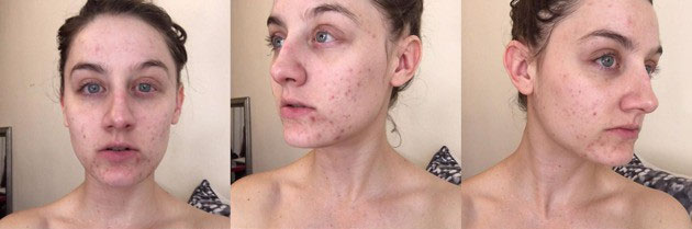 Cắt bỏ một thứ duy nhất trong quy trình chăm sóc da, cô gái nhận lại kết quả mỹ mãn không thể ngờ