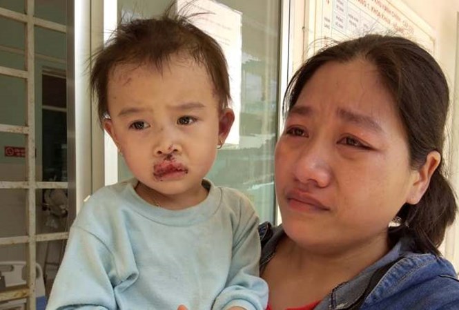 Chồng cụt 2 chân, vợ mang thai chết thương tâm do sập nhà