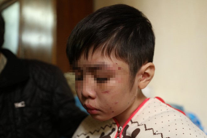 ĐBQH nói bố đẻ bé trai bị hành hạ không có chút tình người