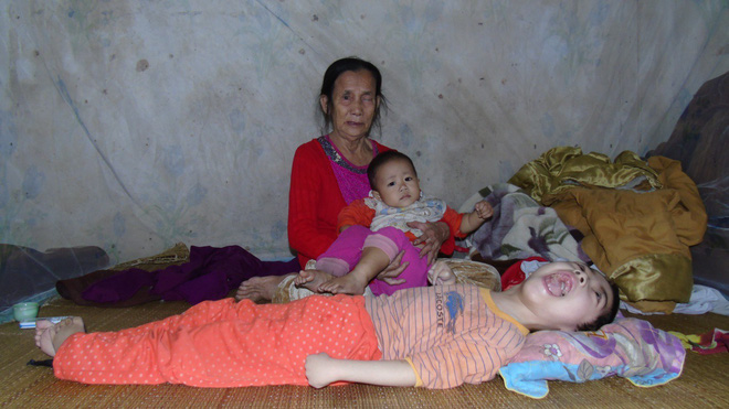 Mỗi ngày buộc phải cho con uống 12 viên thuốc ngủ, người mẹ đau đớn chứng kiến con ngày càng héo úa