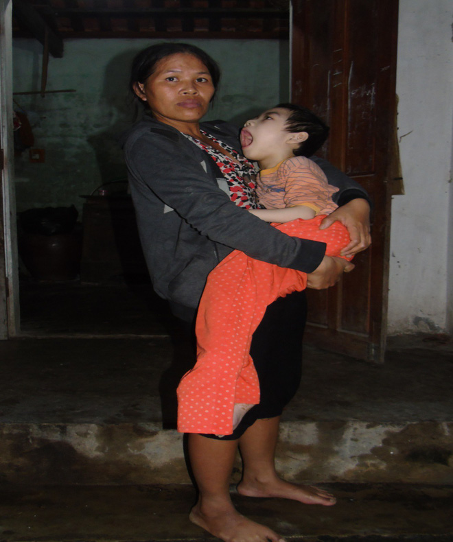 Mỗi ngày buộc phải cho con uống 12 viên thuốc ngủ, người mẹ đau đớn chứng kiến con ngày càng héo úa