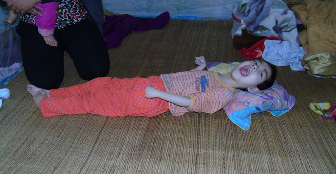 Mỗi ngày buộc phải cho con uống 12 viên thuốc ngủ, người mẹ đau đớn chứng kiến con ngày càng héo úa