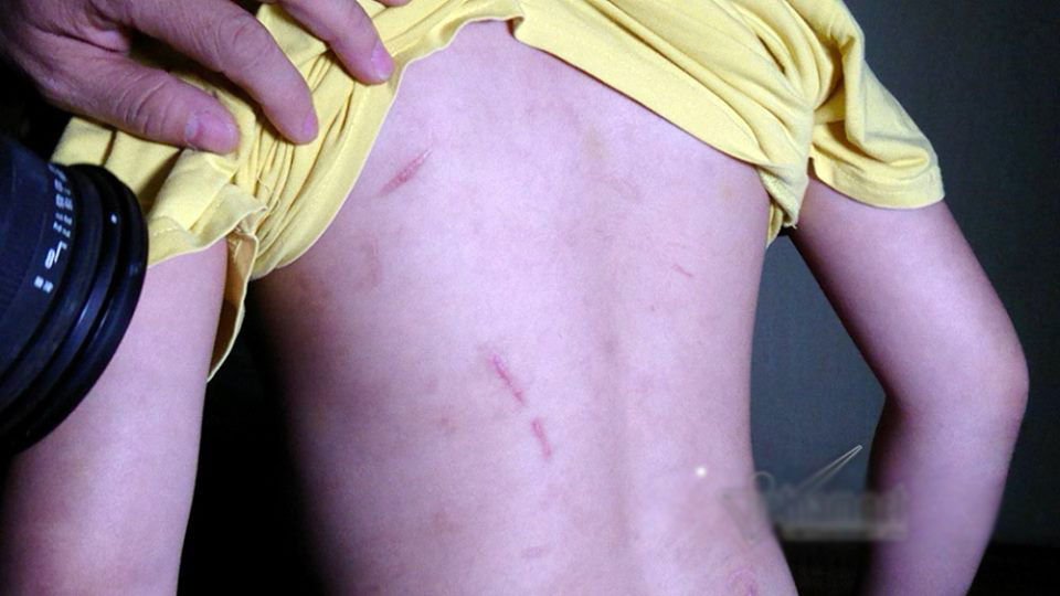 Bố đẻ, mẹ kế bạo hành con dã man sẽ bị phạt tù?