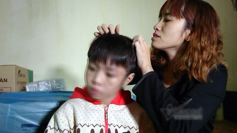 Bố đẻ, mẹ kế bạo hành con dã man sẽ bị phạt tù?