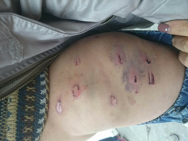 Hà Nội: Bố đẻ dùng dây điện đánh đập con trai 9 tuổi dã man, mẹ đau đớn cầu cứu công an