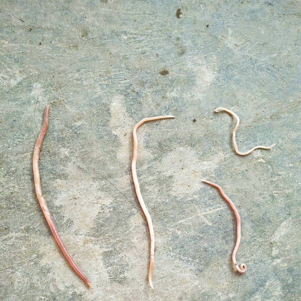 Hãi hùng giun sán dài nửa mét bò ra từ... miệng các em nhỏ