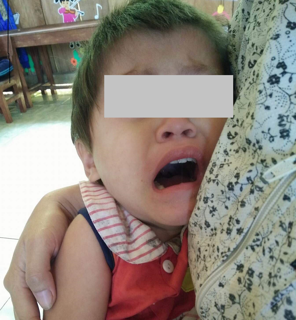 Hãi hùng giun sán dài nửa mét bò ra từ... miệng các em nhỏ