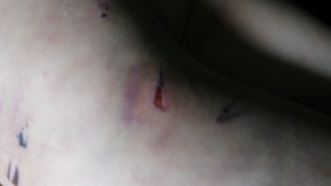 Vụ bé trai trai bị bạo hành ở Đông Anh: Ở trường cháu là học sinh nghịch ngợm