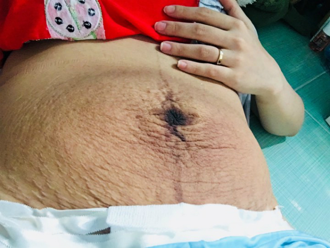 Điều nuối tiếc nhất của Xuân Thảo là không được nghe tiếng con khóc đầu đời