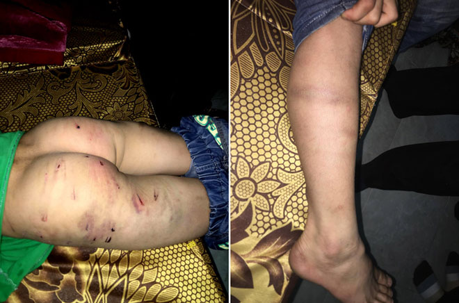 Bố đánh con trai 9 tuổi chi chít sẹo: Tôi không lấy vợ 2 vì còn con cái