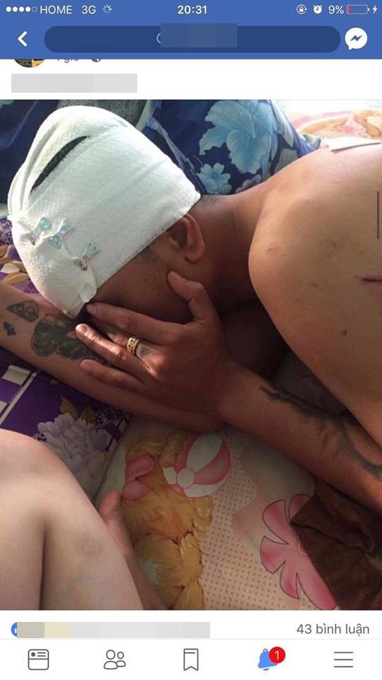 Vụ nhân viên nhà hàng đăng chửi khách: Mâu thuẫn đến mức người nhập viện, kẻ vào đồn CA