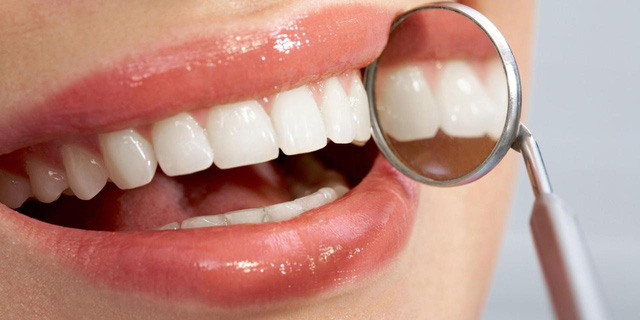 Tiết lộ 5 vấn đề sức khỏe qua răng miệng Tiết lộ 5 vấn đề sức khỏe qua răng miệng