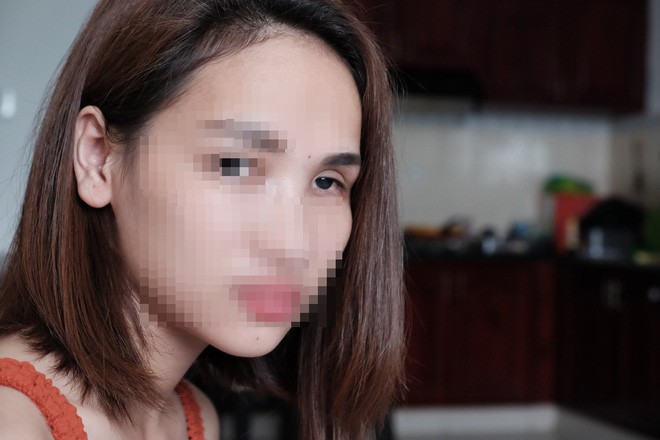 Cô gái mù mắt trái sau khi tiêm filler: Không có bạn trai, tôi đã không gắng gượng được đến lúc này