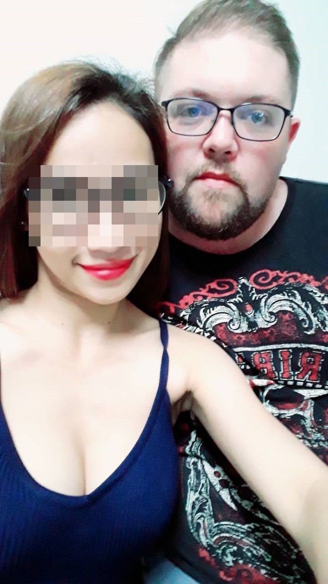 Cô gái mù mắt trái sau khi tiêm filler: Không có bạn trai, tôi đã không gắng gượng được đến lúc này