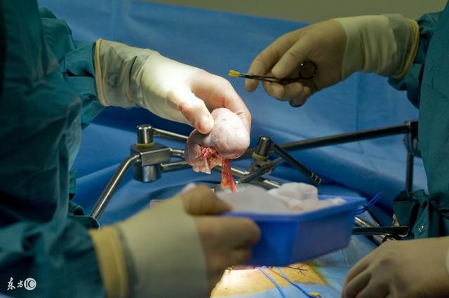 Bán thận vì không coi nó là gốc của sự sống, ai làm tốt 4 việc này thì thận mới bền Bán thận vì không coi nó là gốc của sự sống, ai làm tốt 4 việc này thì thận mới bền