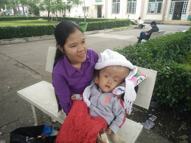 Gần 70 triệu đồng đã giúp bé gái 4 tuổi bị não úng thủy bẩm sinh phẫu thuật thành công, giữ lại mạng sống