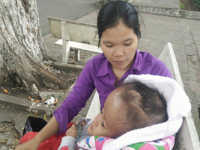 Gần 70 triệu đồng đã giúp bé gái 4 tuổi bị não úng thủy bẩm sinh phẫu thuật thành công, giữ lại mạng sống